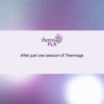 one session of thermage